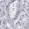 Zinc Finger CCCH-Type Containing 8 antibody, HPA034803, Atlas Antibodies, Immunohistochemistry paraffin image 