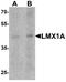 LIM Homeobox Transcription Factor 1 Alpha antibody, A06287, Boster Biological Technology, Western Blot image 
