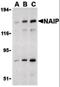 Baculoviral IAP repeat-containing protein 1 antibody, orb86690, Biorbyt, Western Blot image 