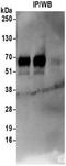 Neutral amino acid transporter B(0) antibody, NBP2-32239, Novus Biologicals, Immunoprecipitation image 