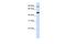 Rhomboid 5 Homolog 1 antibody, A08544, Boster Biological Technology, Western Blot image 