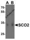 SCO Cytochrome C Oxidase Assembly Protein 2 antibody, 4045, ProSci, Western Blot image 