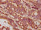 Growth Differentiation Factor 5 antibody, LS-C375779, Lifespan Biosciences, Immunohistochemistry paraffin image 