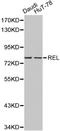 REL Proto-Oncogene, NF-KB Subunit antibody, LS-C192439, Lifespan Biosciences, Western Blot image 