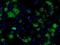 Fumarylacetoacetate Hydrolase Domain Containing 2A antibody, MA5-25048, Invitrogen Antibodies, Immunocytochemistry image 