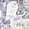 LSM2 Homolog, U6 Small Nuclear RNA And MRNA Degradation Associated antibody, A07586-1, Boster Biological Technology, Immunohistochemistry paraffin image 