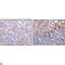 Bruton Tyrosine Kinase antibody, LS-C812406, Lifespan Biosciences, Immunohistochemistry paraffin image 