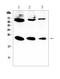 Interleukin 2 antibody, A00387-1, Boster Biological Technology, Enzyme Linked Immunosorbent Assay image 