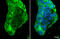 ATP Binding Cassette Subfamily A Member 1 antibody, GTX132946, GeneTex, Immunofluorescence image 