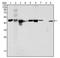 KRT18 antibody, AM06282SU-N, Origene, Western Blot image 