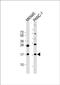 Shisa Like 2B antibody, PA5-72335, Invitrogen Antibodies, Western Blot image 
