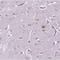 UDP-GlcNAc:BetaGal Beta-1,3-N-Acetylglucosaminyltransferase 4 antibody, NBP2-30927, Novus Biologicals, Immunohistochemistry frozen image 