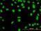 YY1 Transcription Factor antibody, H00007528-M01, Novus Biologicals, Immunocytochemistry image 