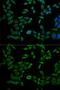 VAMP Associated Protein B And C antibody, GTX32958, GeneTex, Immunofluorescence image 