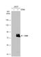 ETS Variant 5 antibody, NBP2-14950, Novus Biologicals, Western Blot image 