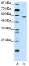 YY1 Transcription Factor antibody, TA343383, Origene, Western Blot image 