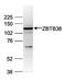 Zinc Finger And BTB Domain Containing 38 antibody, PA5-40073, Invitrogen Antibodies, Western Blot image 