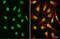 Nuclear Mitotic Apparatus Protein 1 antibody, GTX629397, GeneTex, Immunocytochemistry image 
