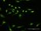 Denticleless protein homolog antibody, H00051514-D01P, Novus Biologicals, Immunocytochemistry image 