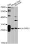 Major Histocompatibility Complex, Class II, DR Beta 3 antibody, A12444, ABclonal Technology, Western Blot image 