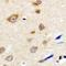 Neuroblastoma breakpoint family member 5 antibody, LS-C368907, Lifespan Biosciences, Immunohistochemistry frozen image 