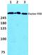 Coagulation Factor VIII antibody, AP06114PU-N, Origene, Western Blot image 