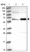 MINDY Lysine 48 Deubiquitinase 2 antibody, PA5-62318, Invitrogen Antibodies, Western Blot image 