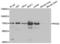 Protein Inhibitor Of Activated STAT 2 antibody, LS-C334194, Lifespan Biosciences, Western Blot image 