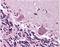 Cerebellar degeneration-related protein 2 antibody, NB110-58345, Novus Biologicals, Immunohistochemistry paraffin image 