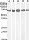 Probable ATP-dependent RNA helicase DDX5 antibody, LS-C54712, Lifespan Biosciences, Western Blot image 
