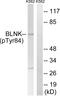 BLNK antibody, abx012637, Abbexa, Western Blot image 