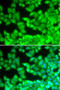 CD40 Ligand antibody, STJ23001, St John