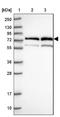 Ubiquitin carboxyl-terminal hydrolase 22 antibody, NBP1-82941, Novus Biologicals, Western Blot image 