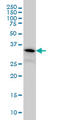 PIH1 Domain Containing 1 antibody, LS-C133771, Lifespan Biosciences, Western Blot image 
