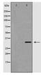 Voltage-dependent anion-selective channel protein 2 antibody, TA348006, Origene, Western Blot image 