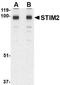 Stromal interaction molecule 2 antibody, NBP1-76790, Novus Biologicals, Western Blot image 