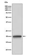 Claudin 5 antibody, M03260, Boster Biological Technology, Western Blot image 