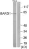 BRCA1 Associated RING Domain 1 antibody, abx014012, Abbexa, Western Blot image 