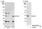 DnaJ Heat Shock Protein Family (Hsp40) Member C8 antibody, NB100-97847, Novus Biologicals, Western Blot image 