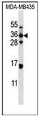 ELOVL Fatty Acid Elongase 5 antibody, AP51421PU-N, Origene, Western Blot image 