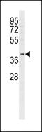 Free Fatty Acid Receptor 2 antibody, 59-986, ProSci, Western Blot image 