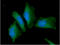 Alpha Fetoprotein antibody, GTX57721, GeneTex, Immunofluorescence image 