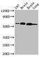 Dihydropyrimidinase Like 2 antibody, orb400636, Biorbyt, Western Blot image 