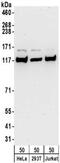 Kinesin Family Member 5B antibody, NBP2-32279, Novus Biologicals, Western Blot image 