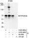 Protein Phosphatase 2 Regulatory Subunit B''Beta antibody, A300-965A, Bethyl Labs, Immunoprecipitation image 