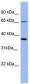 Tamm-Horsfall urinary glycoprotein antibody, TA346058, Origene, Western Blot image 