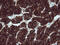 B- and T-lymphocyte attenuator antibody, M03149-1, Boster Biological Technology, Immunohistochemistry paraffin image 