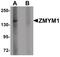Zinc Finger MYM-Type Containing 1 antibody, PA5-21089, Invitrogen Antibodies, Western Blot image 