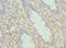 LIM Zinc Finger Domain Containing 1 antibody, LS-C675993, Lifespan Biosciences, Immunohistochemistry paraffin image 