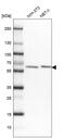 Putative adenosylhomocysteinase 2 antibody, HPA042589, Atlas Antibodies, Western Blot image 